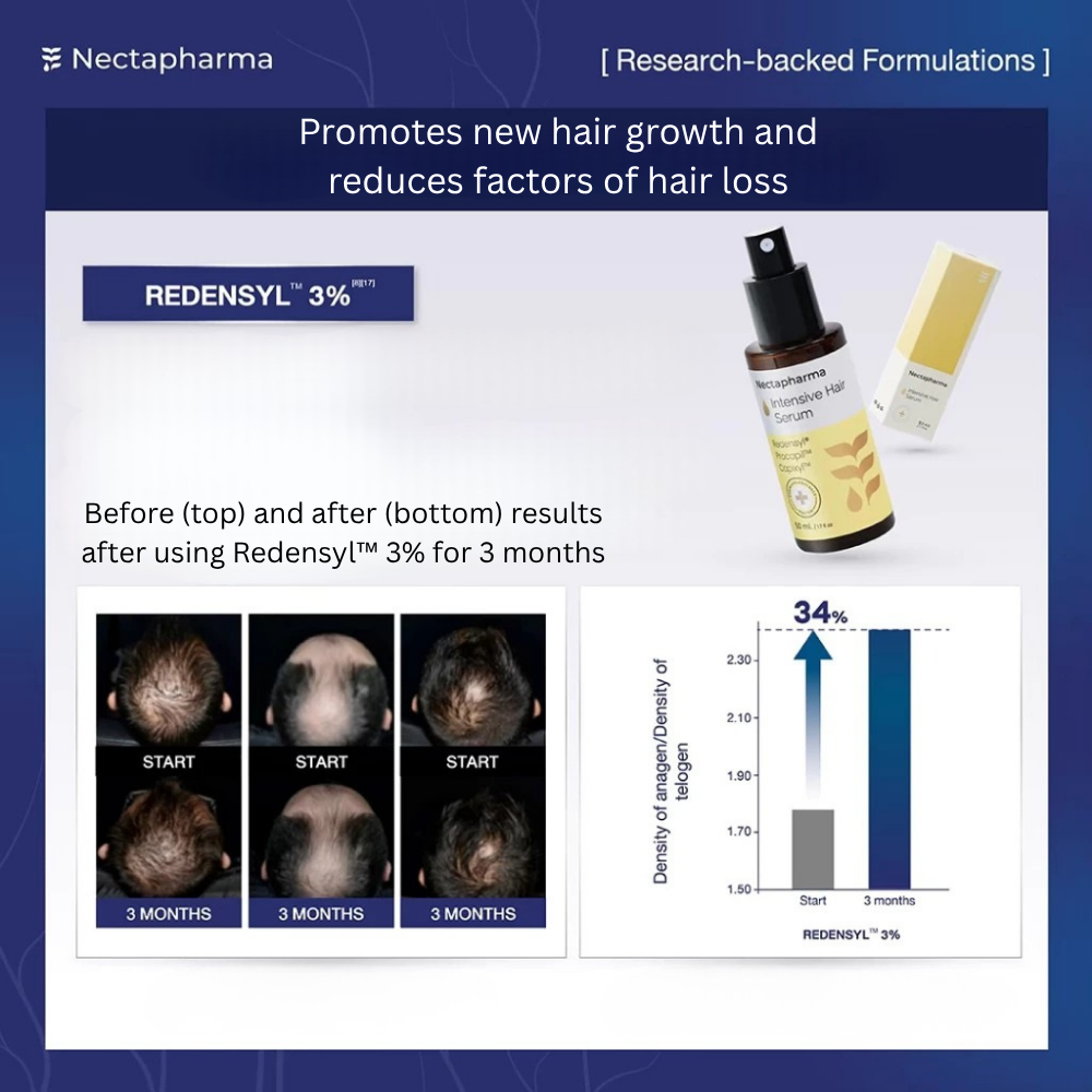 Intensive Hair Serum – Anti Hair Loss & Hair Regrowth Formula