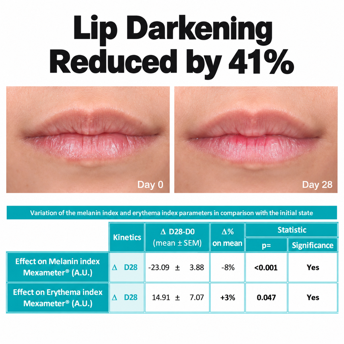 Dr.PONG 28D Whitening Drone Lip Mask 8.5g