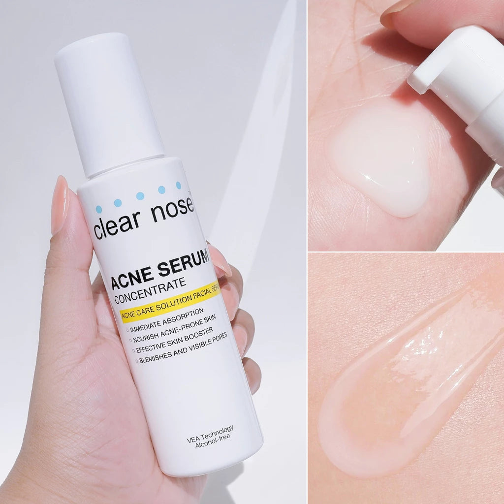 Clear Nose Acne Serum 100ml
